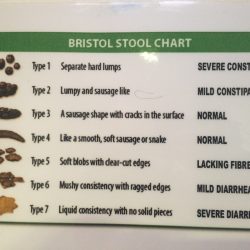 Stool chart